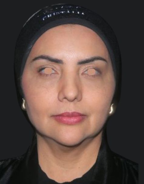antes e depois (3)